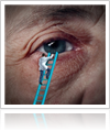 Custom Cataract Surgery at Gerstein Eye Institute