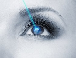 Lasik Vision Correction in Chicago