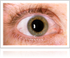 Diabetic Eye Disease treatment