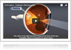 Risk of diabetic retinopathy